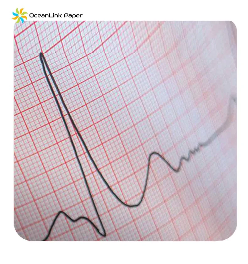 High Sensitivity Medical Grade ECG/EKG Thermal Paper